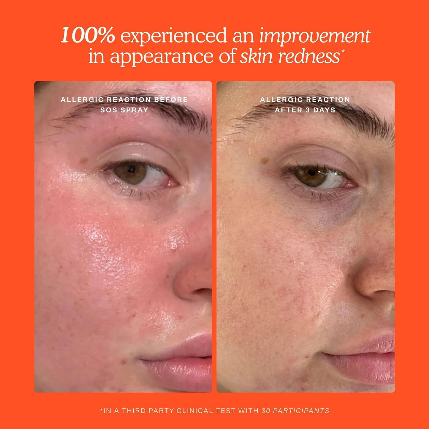 SOS Recovery Hydrating Face Cream for Sensitive Skin (1.86 Oz)
